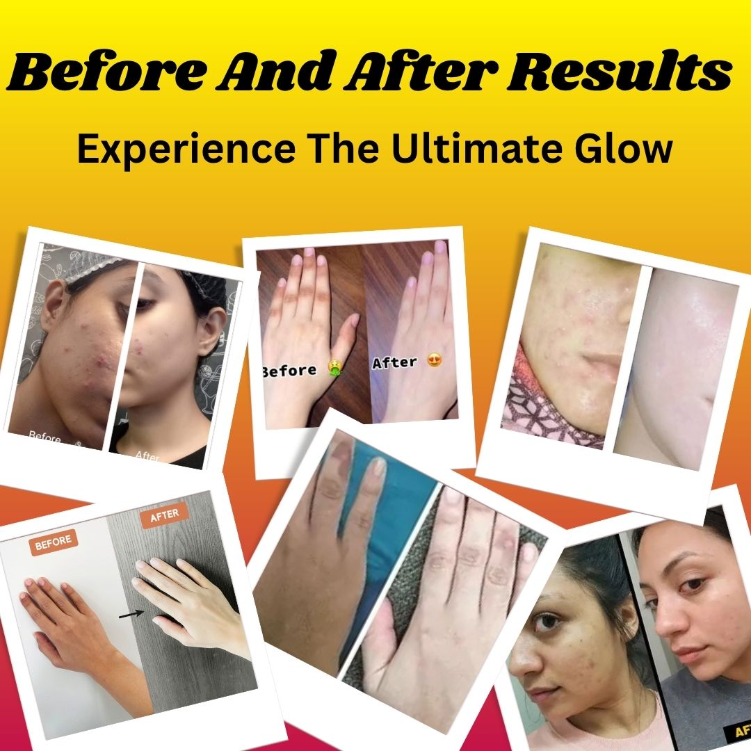 Full Body Whitening Syrups For Men & Women