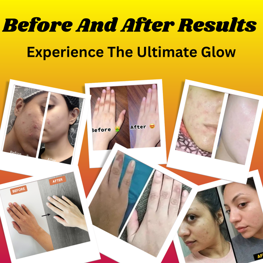 Full Body Whitening Syrups For Men & Women